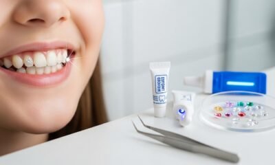 Tooth Gems: How to Safely Apply Sparkling Accessories at Home